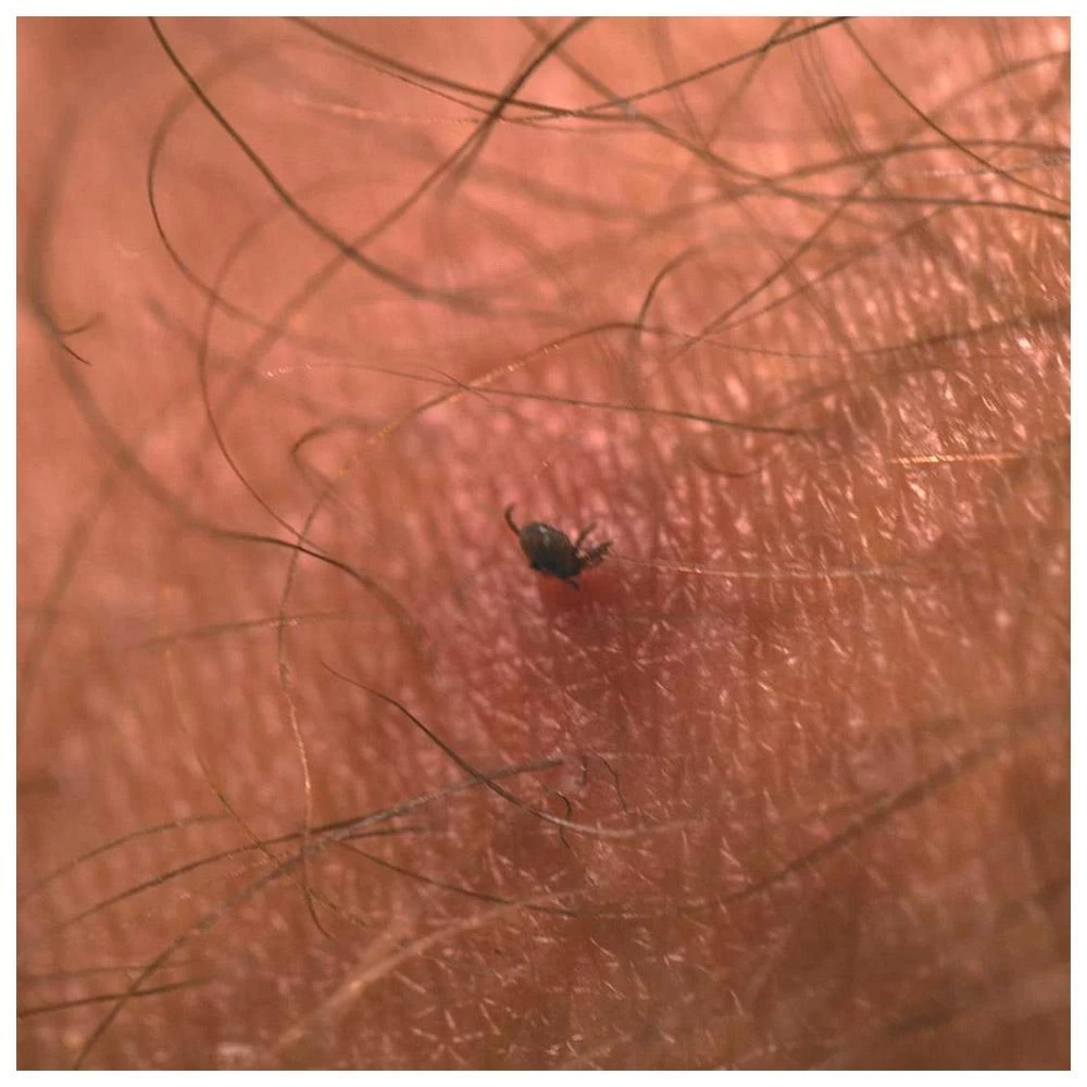 Tire-tique Lifesystems Tick Card White – Image 3